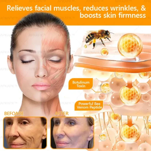 LBMLBM™ Bee venom Comprehensive Cream