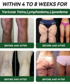Myo Clinic® 𝐺𝐿𝑃-1 9 𝐼𝑁 1 𝐻𝑒𝑎𝑙𝑡ℎ 𝑆𝑜𝑙𝑢𝑡𝑖𝑜𝑛 𝑂𝑟𝑎𝑙 𝐿𝑖𝑞𝑢𝑖𝑑
