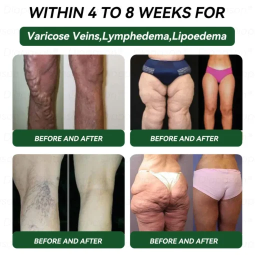 Myo Clinic® 𝐺𝐿𝑃-1 9 𝐼𝑁 1 𝐻𝑒𝑎𝑙𝑡ℎ 𝑆𝑜𝑙𝑢𝑡𝑖𝑜𝑛 𝑂𝑟𝑎𝑙 𝐿𝑖𝑞𝑢𝑖𝑑