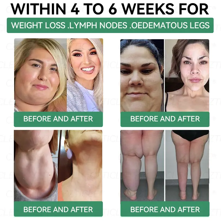 ๐๐๐๐๐๐๐๐ & ๐ป๐๐๐๐กโ ๐๐๐ ๐๐ ๐
๐๐๐ - Image 5