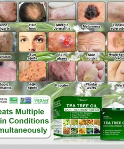 𝐓𝐞𝐚 𝐓𝐫𝐞𝐞 𝐎𝐢𝐥 𝐒𝐤𝐢𝐧 𝐓𝐫𝐞𝐚𝐭𝐦𝐞𝐧𝐭 𝐂𝐫𝐞𝐚𝐦