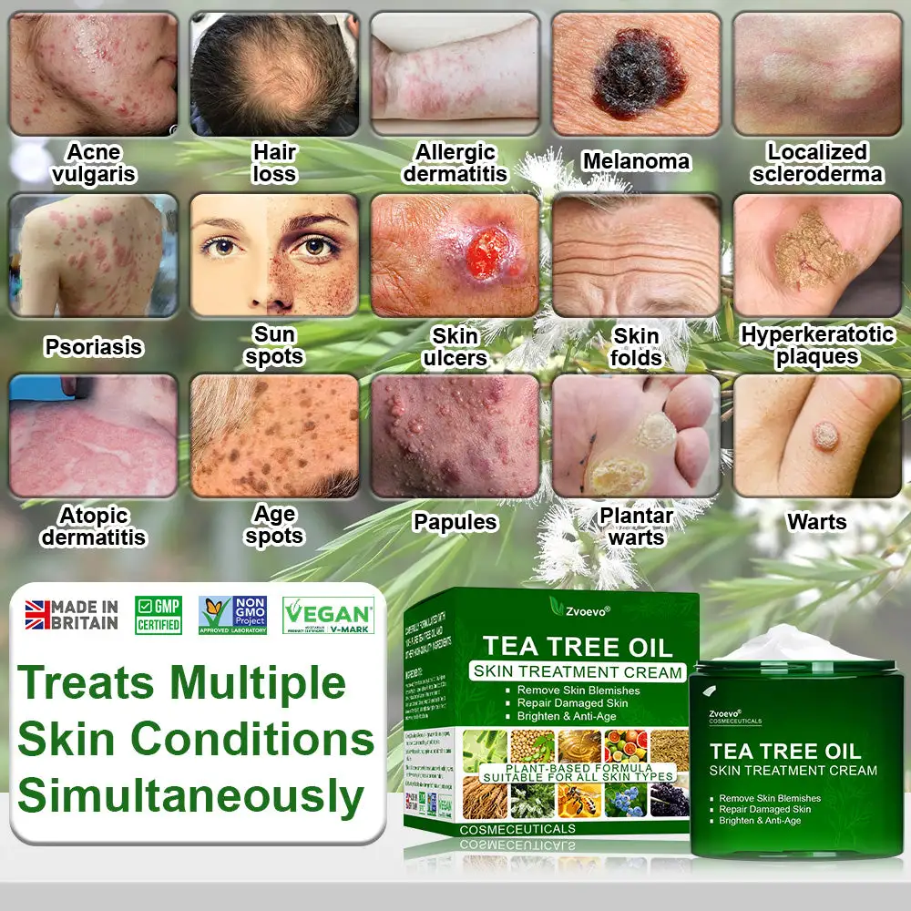 ๐๐๐ ๐๐ซ๐๐ ๐๐ข๐ฅ ๐๐ค๐ข๐ง ๐๐ซ๐๐๐ญ๐ฆ๐๐ง๐ญ ๐๐ซ๐๐๐ฆ