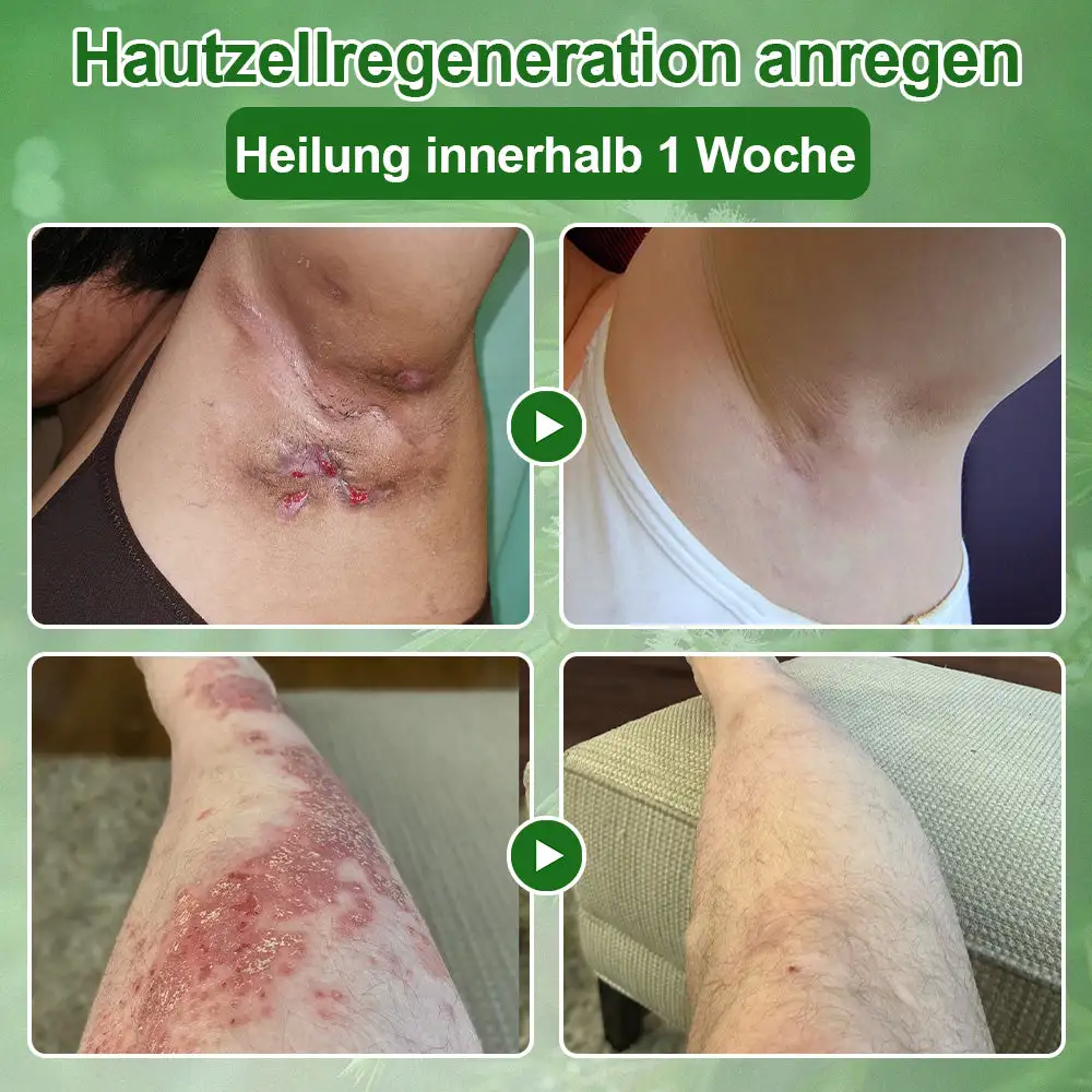 ๐๐๐๐๐๐ฎ๐ฆ๐จฬ๐ฅ ๐๐๐ฎ๐ญ๐ฉ๐๐ฅ๐๐ ๐๐๐๐ก๐๐ง๐๐ฅ๐ฎ๐ง๐ ๐๐ซ๐๐ฆ๐ - Image 6