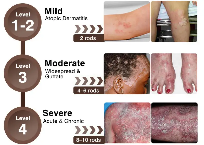 ๐๐ฎ๐ฅ๐ญ๐ข-๐๐ฒ๐ฆ๐ฉ๐ญ๐จ๐ฆ ๐๐ฌ๐จ๐ซ๐ข๐๐ฌ๐ข๐ฌ & ๐๐๐ณ๐๐ฆ๐ ๐๐ซ๐๐๐ญ๐ฆ๐๐ง๐ญ ๐๐ซ๐๐๐ฆ - Image 10