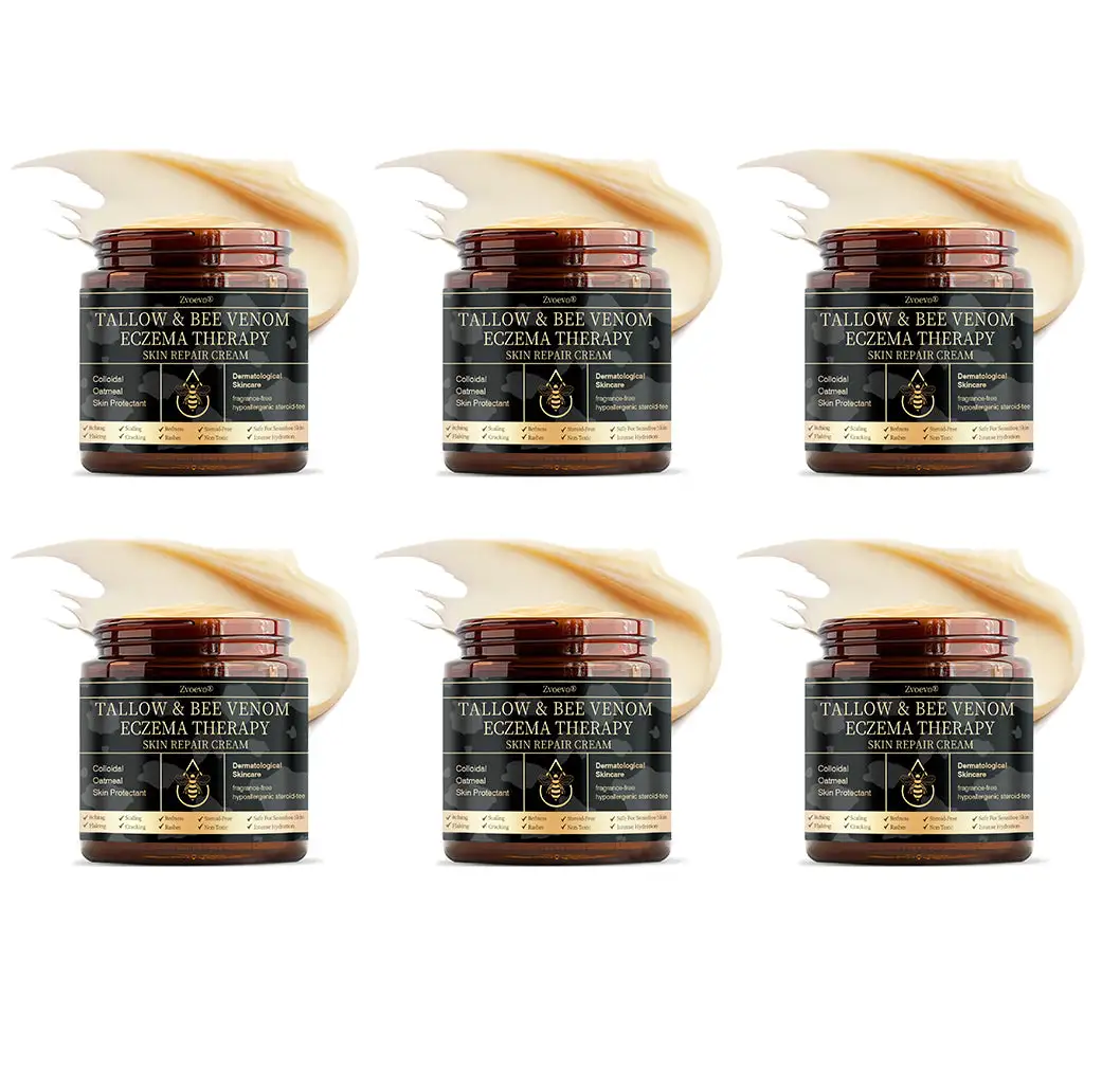 ๐๐ฎ๐ฅ๐ญ๐ข-๐๐ฒ๐ฆ๐ฉ๐ญ๐จ๐ฆ ๐๐ฌ๐จ๐ซ๐ข๐๐ฌ๐ข๐ฌ & ๐๐๐ณ๐๐ฆ๐ ๐๐ซ๐๐๐ญ๐ฆ๐๐ง๐ญ ๐๐ซ๐๐๐ฆ - Image 14