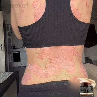 ๐๐ฎ๐ฅ๐ญ๐ข-๐๐ฒ๐ฆ๐ฉ๐ญ๐จ๐ฆ ๐๐ฌ๐จ๐ซ๐ข๐๐ฌ๐ข๐ฌ & ๐๐๐ณ๐๐ฆ๐ ๐๐ซ๐๐๐ญ๐ฆ๐๐ง๐ญ ๐๐ซ๐๐๐ฆ - Image 2