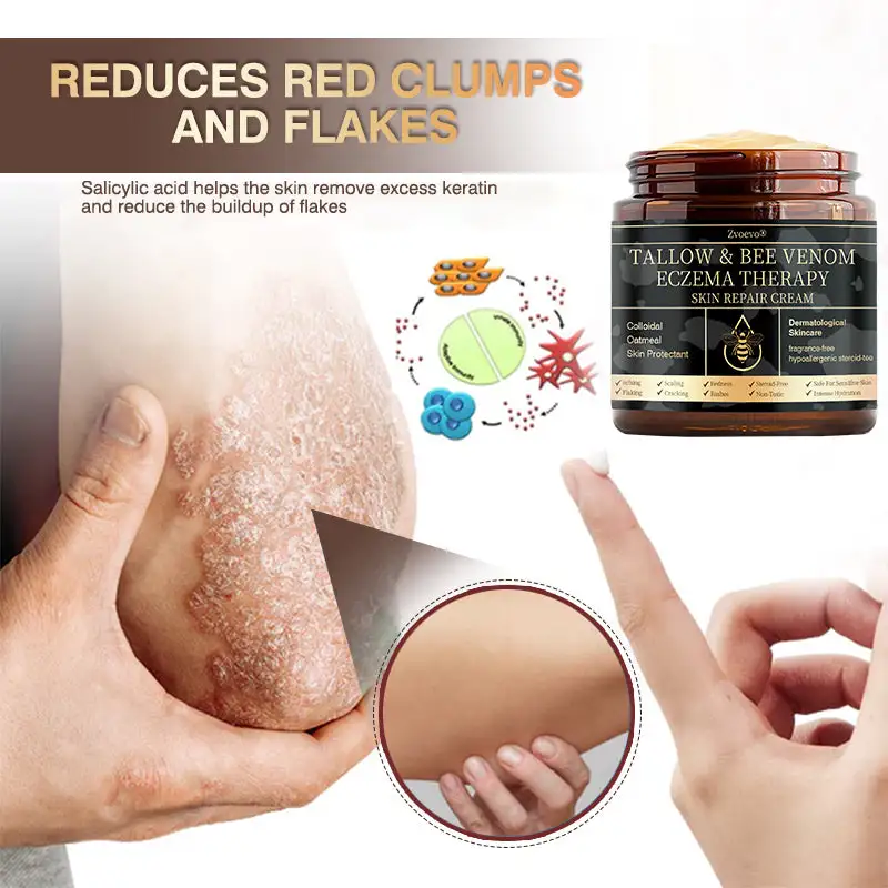 ๐๐ฎ๐ฅ๐ญ๐ข-๐๐ฒ๐ฆ๐ฉ๐ญ๐จ๐ฆ ๐๐ฌ๐จ๐ซ๐ข๐๐ฌ๐ข๐ฌ & ๐๐๐ณ๐๐ฆ๐ ๐๐ซ๐๐๐ญ๐ฆ๐๐ง๐ญ ๐๐ซ๐๐๐ฆ - Image 3