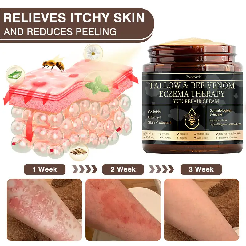 ๐๐ฎ๐ฅ๐ญ๐ข-๐๐ฒ๐ฆ๐ฉ๐ญ๐จ๐ฆ ๐๐ฌ๐จ๐ซ๐ข๐๐ฌ๐ข๐ฌ & ๐๐๐ณ๐๐ฆ๐ ๐๐ซ๐๐๐ญ๐ฆ๐๐ง๐ญ ๐๐ซ๐๐๐ฆ - Image 8