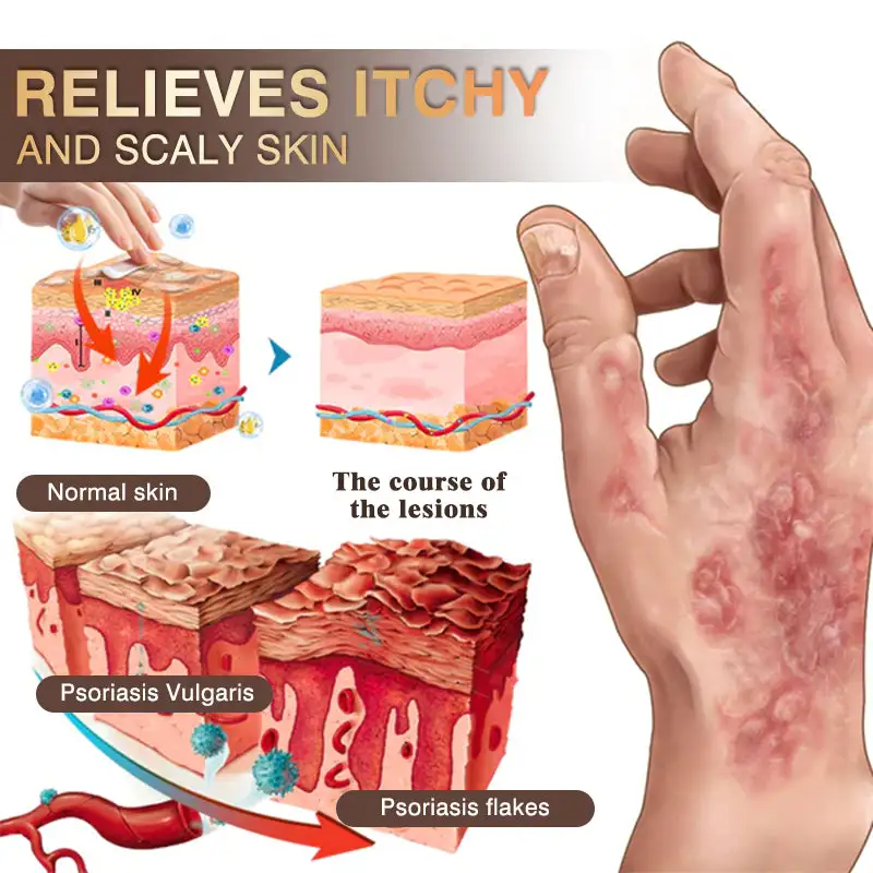 ๐๐ฎ๐ฅ๐ญ๐ข-๐๐ฒ๐ฆ๐ฉ๐ญ๐จ๐ฆ ๐๐ฌ๐จ๐ซ๐ข๐๐ฌ๐ข๐ฌ & ๐๐๐ณ๐๐ฆ๐ ๐๐ซ๐๐๐ญ๐ฆ๐๐ง๐ญ ๐๐ซ๐๐๐ฆ - Image 9