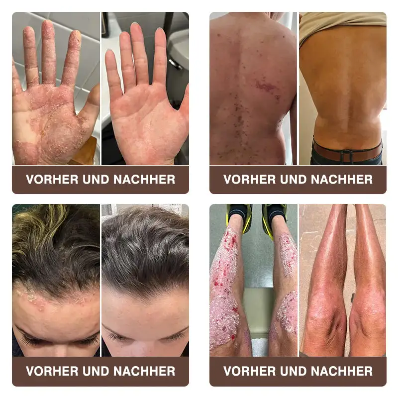 ๐๐ข๐๐ง๐๐ง๐ ๐ข๐๐ญ ๐๐ฎ๐ฅ๐ญ๐ข๐๐ฎ๐ง๐ค๐ญ๐ข๐จ๐ง๐ฌ-๐๐ก๐๐ซ๐๐ฉ๐ข๐๐๐ซ๐๐ฆ๐ - Image 5