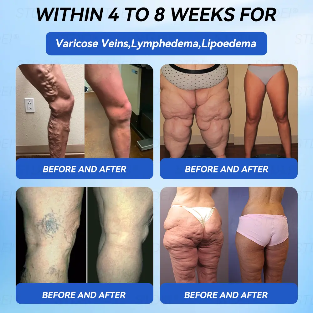 ๐๐๐๐๐๐๐๐ & ๐ป๐๐๐๐กโ๐ฆ ๐ด๐๐๐๐ข๐๐ ๐๐๐๐ ๐ฟ๐๐๐ข๐๐ - Image 8