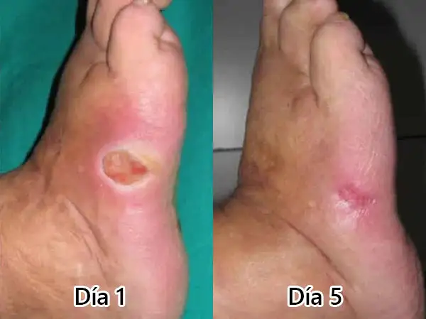 𝗠𝐮𝐥𝘁𝗶-𝗔𝗰𝐭𝗶𝗼𝐧 𝗢𝗿𝗮𝗹 𝗔𝗺𝐩𝗼𝘂𝗹𝗲𝐬 - Image 27