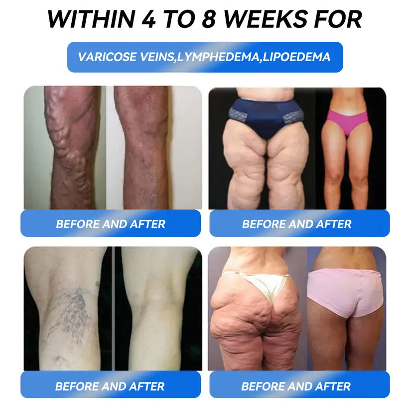 ๐๐๐๐๐๐๐๐ ๐๐ข๐๐๐๐๐ก ๐ท๐๐๐๐ - Image 4