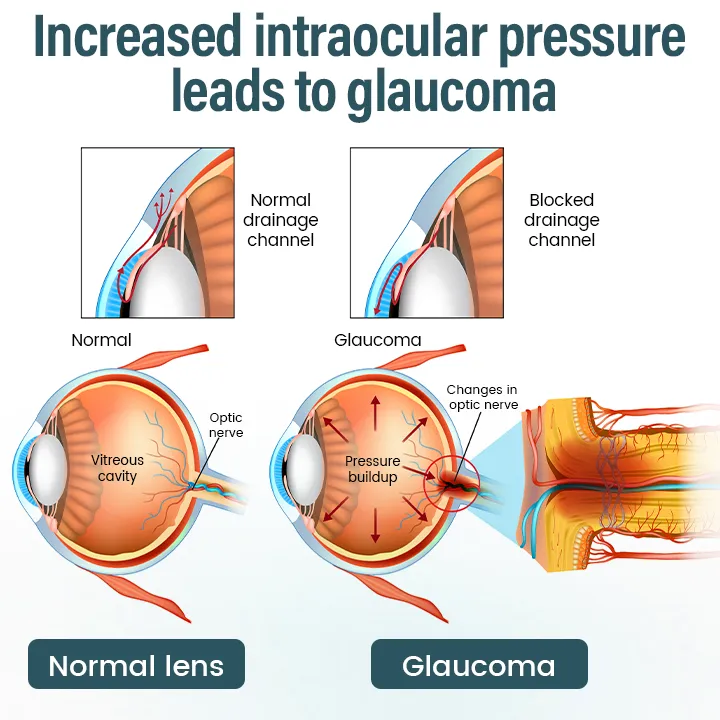 OptiFusion Nano Eye Drops Serum - Image 4