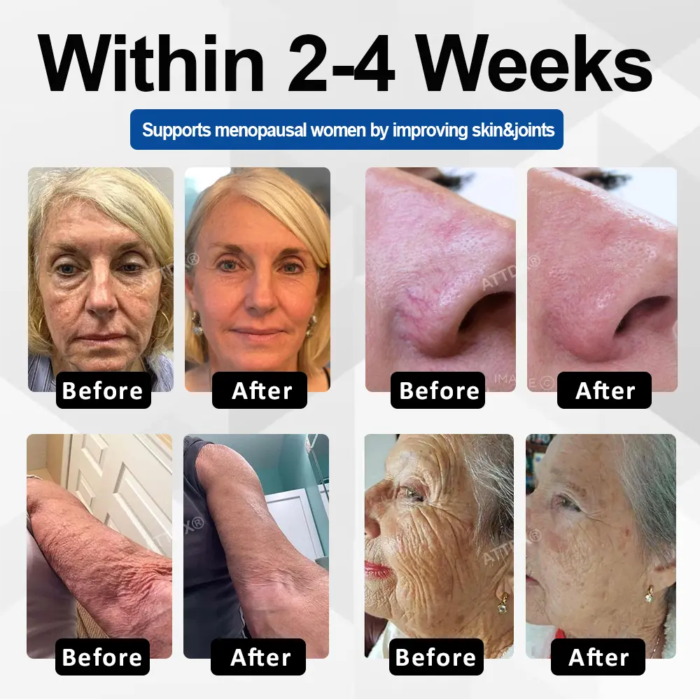 CollaRenew Complex Inner Rebuild Capsules - Image 2