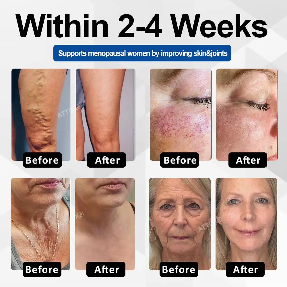 CollaRenew Complex Inner Rebuild Capsules - Image 3