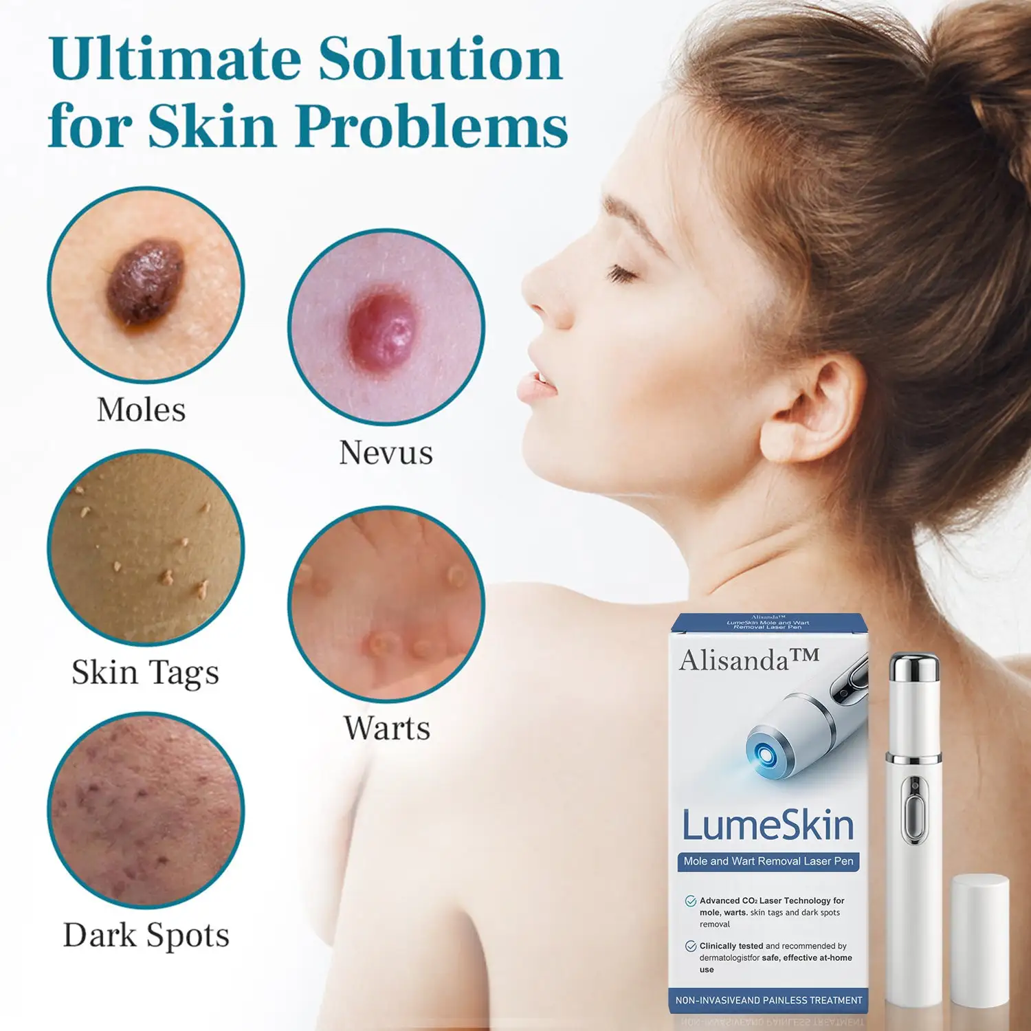 LumeSkin Mole and Wart Removal Laser Pen - Image 9