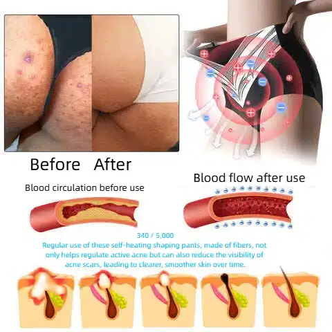 Self-regulating tourmaline shaping shorts with titanium fiber - Image 7