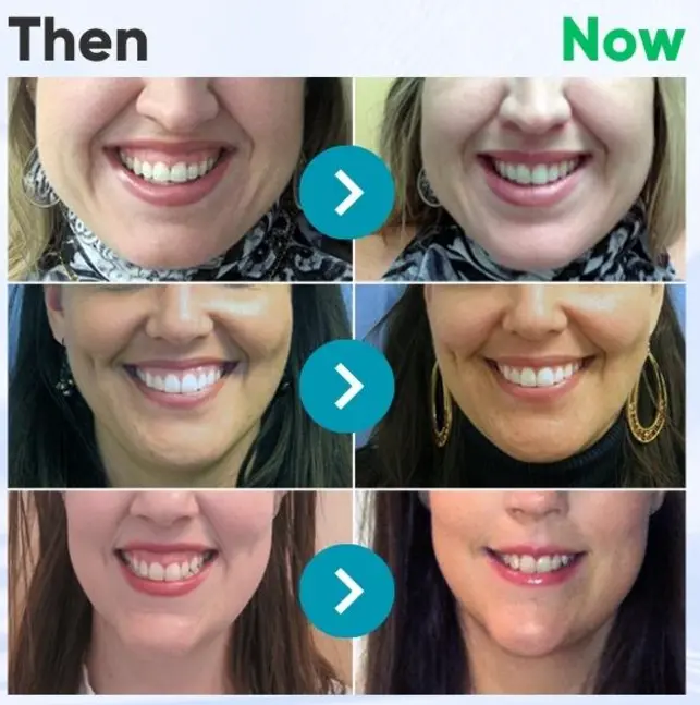 VioGloss Bee Venom Dental Therapy Oral Power - Image 4