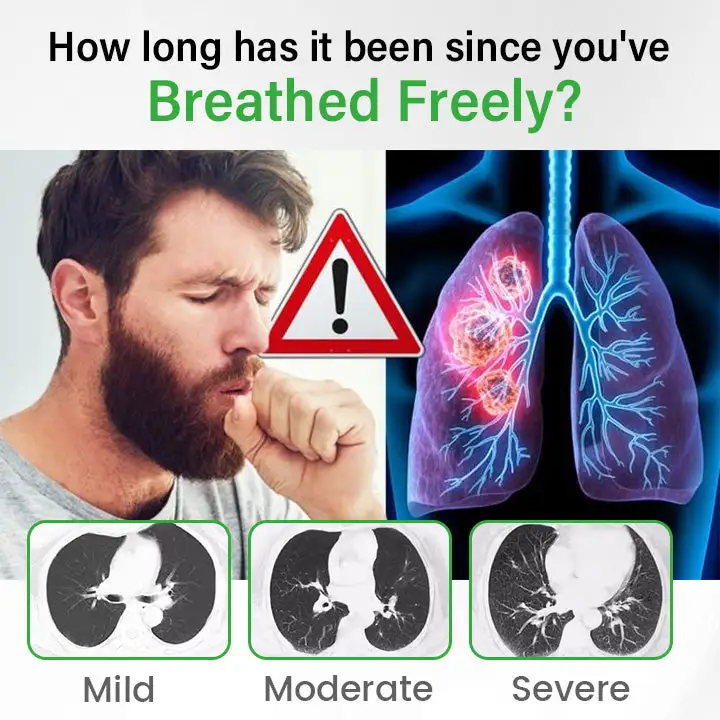 Lung health Detox Inhaler - Image 4