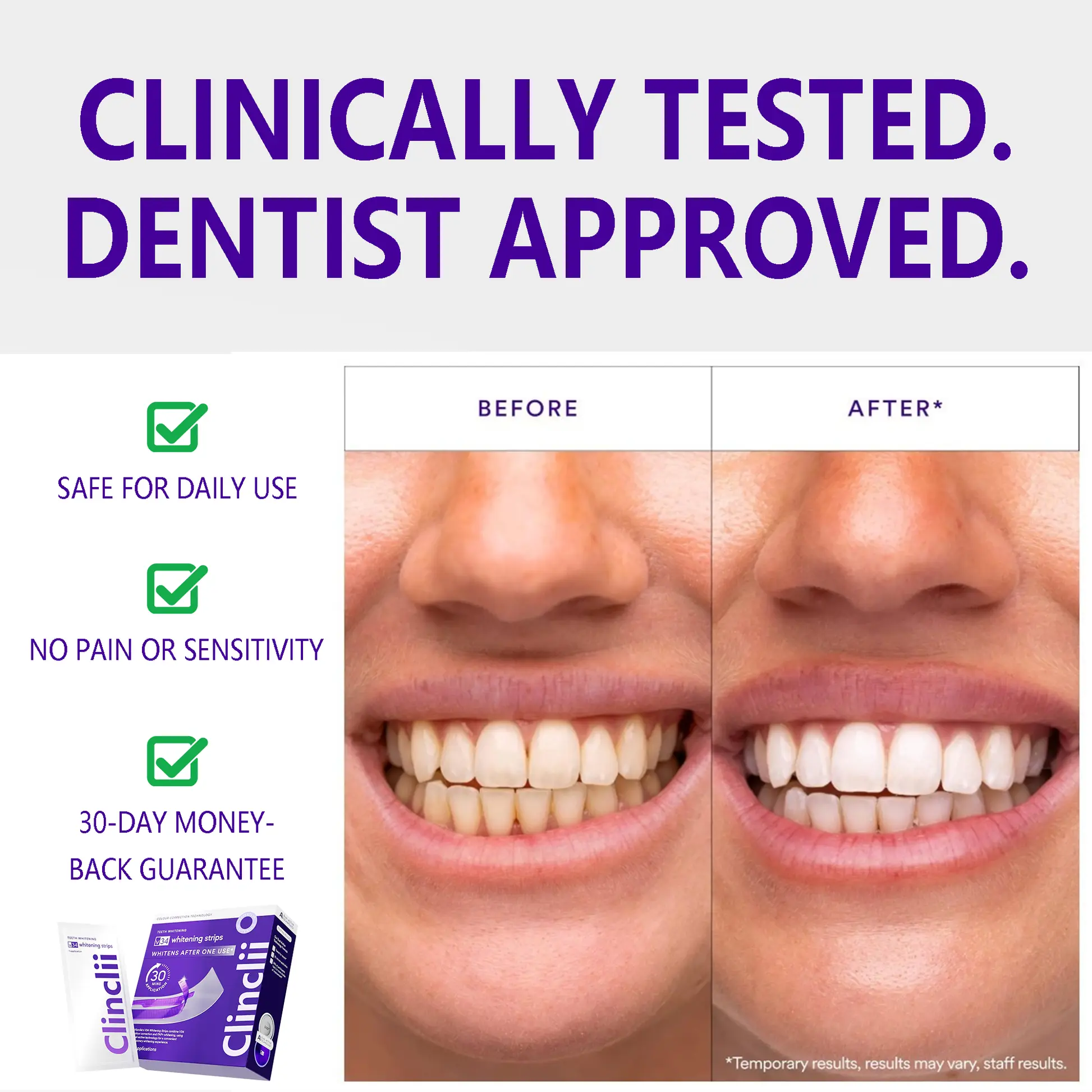 V36 Whitening Strips – Professional Teeth Whitening at Home - Image 3