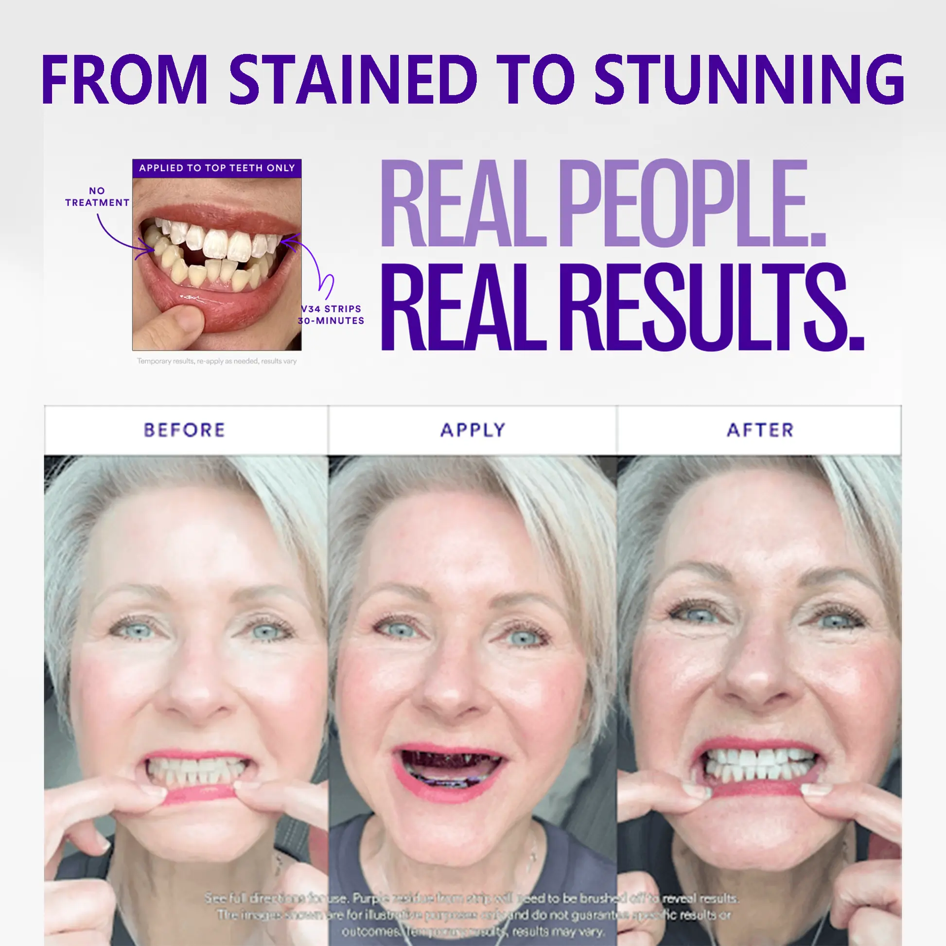 V36 Whitening Strips – Professional Teeth Whitening at Home - Image 4