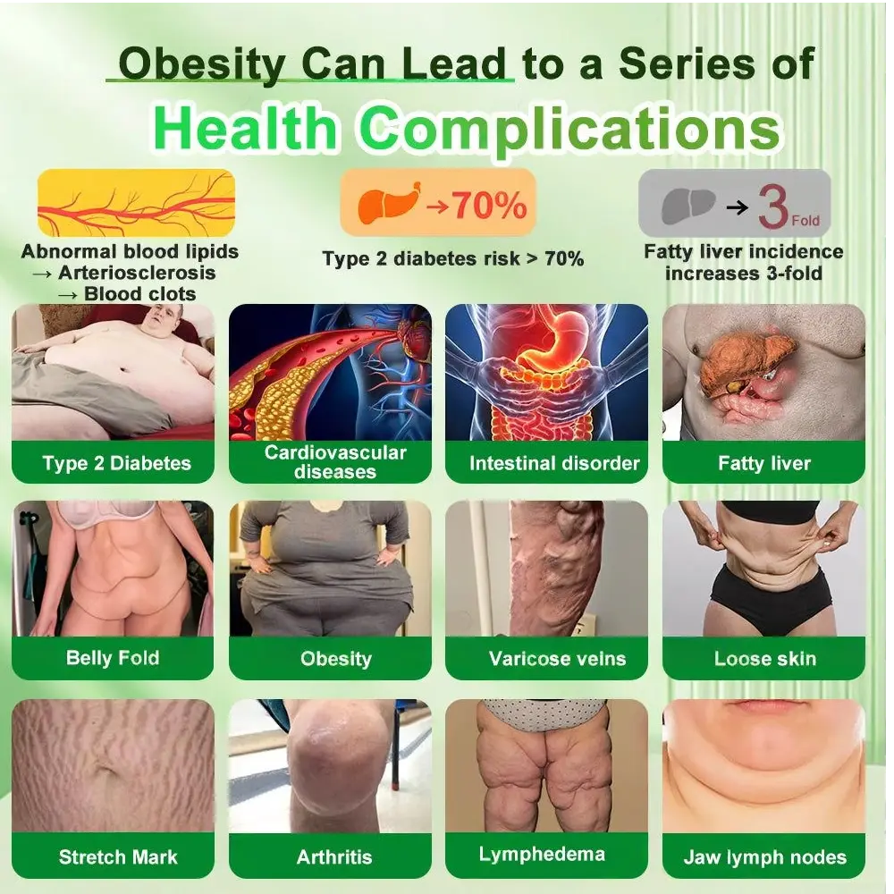 ๐๐-๐ข๐ง-๐ ๐๐ฅ๐ข๐ฆ& ๐ฏ๐๐๐๐๐๐ฒ ๐ถ๐๐๐ ๐บ๐๐๐๐๐๐๐ - Image 8