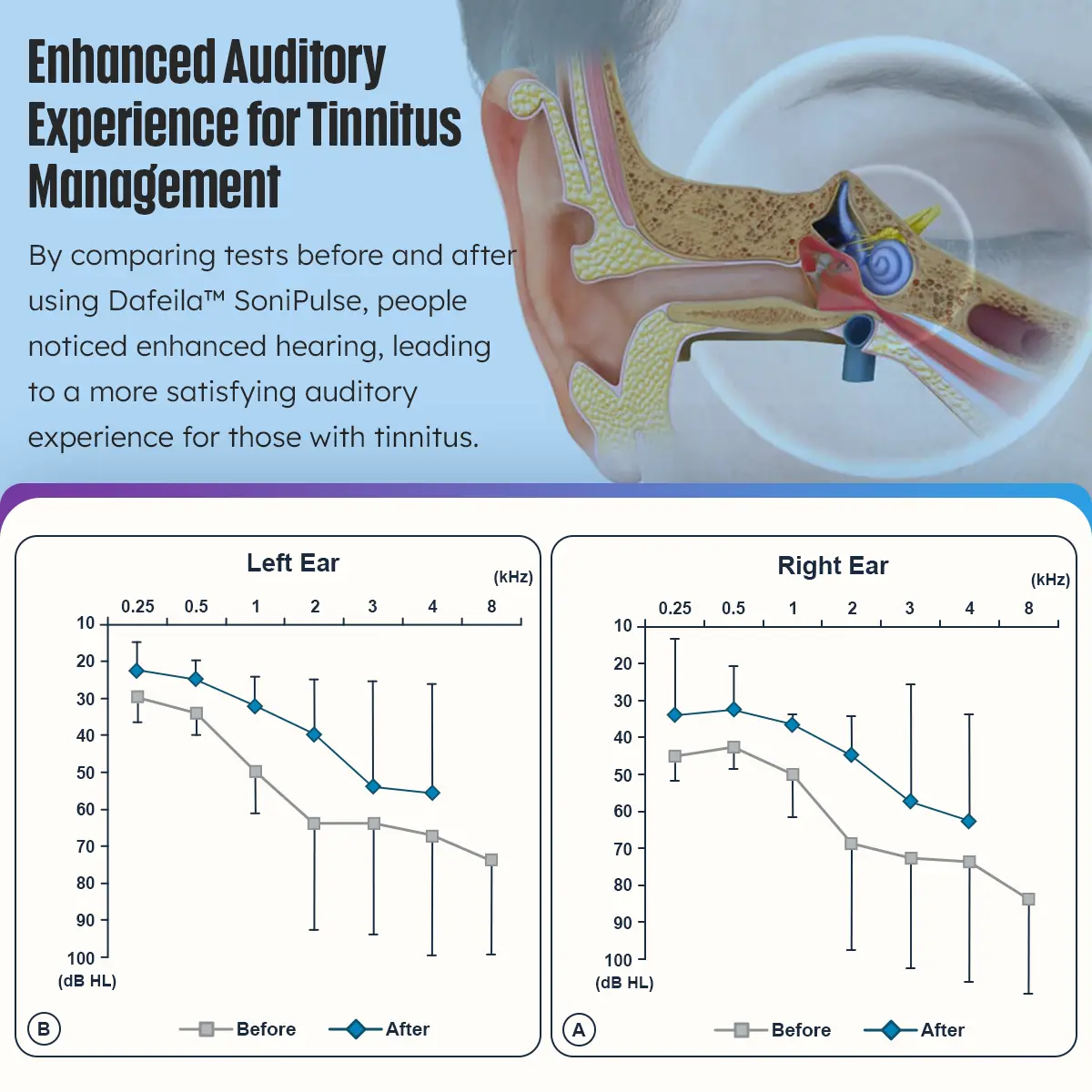SoniPulse Tinnitus Relief Soothing Aid - Image 5
