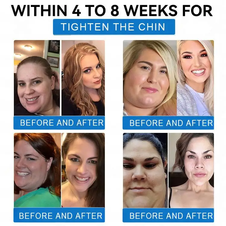 ๐๐จ๐ฅ๐ฅ๐๐ ๐๐ง ๐๐๐ง๐จ ๐๐ข๐๐ซ๐จ๐ง๐๐๐๐ฅ๐ ๐๐๐ข๐ ๐ก๐ญ ๐๐จ๐ฌ๐ฌ ๐๐๐ญ๐๐ก - Image 7