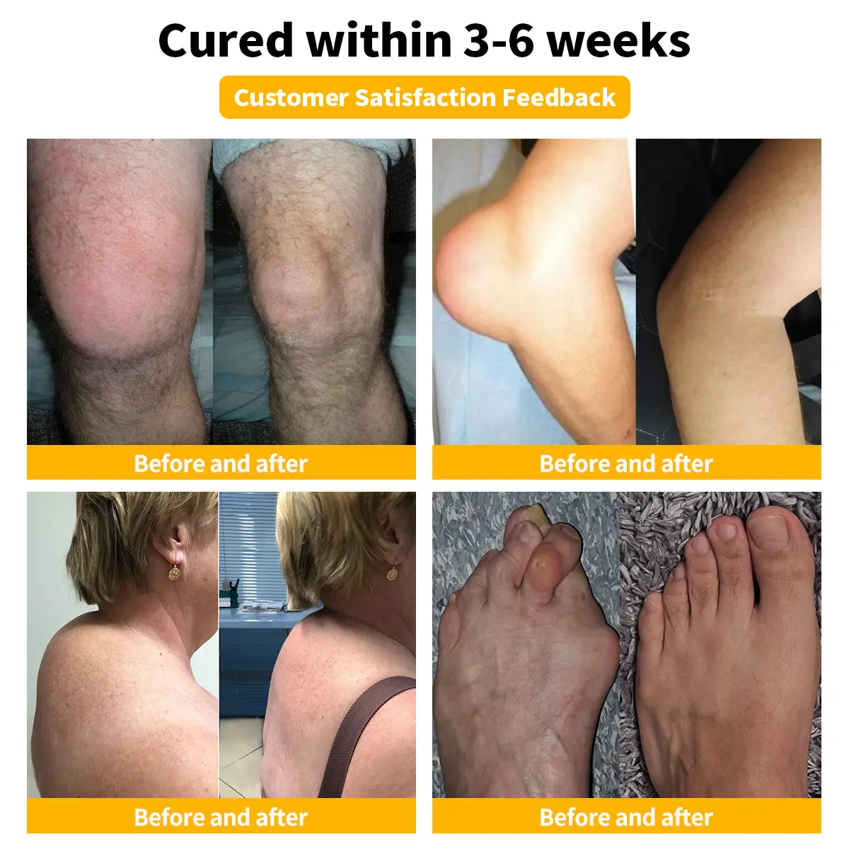 Bee Venom Advanced Joint and Bone Healing Cream - Image 2