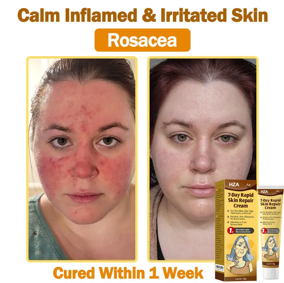 ๐-๐๐๐ฒ ๐๐๐ฉ๐ข๐ ๐๐ค๐ข๐ง ๐๐๐ฉ๐๐ข๐ซ ๐๐ซ๐๐๐ฆ - Image 10