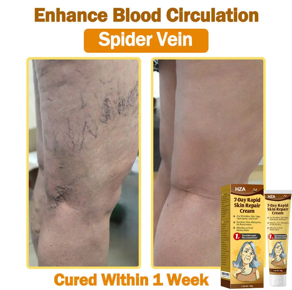 ๐-๐๐๐ฒ ๐๐๐ฉ๐ข๐ ๐๐ค๐ข๐ง ๐๐๐ฉ๐๐ข๐ซ ๐๐ซ๐๐๐ฆ - Image 11