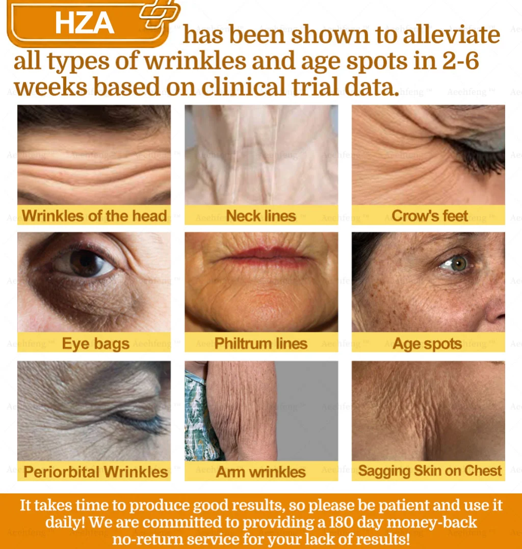 ๐-๐๐๐ฒ ๐๐๐ฉ๐ข๐ ๐๐ค๐ข๐ง ๐๐๐ฉ๐๐ข๐ซ ๐๐ซ๐๐๐ฆ - Image 13