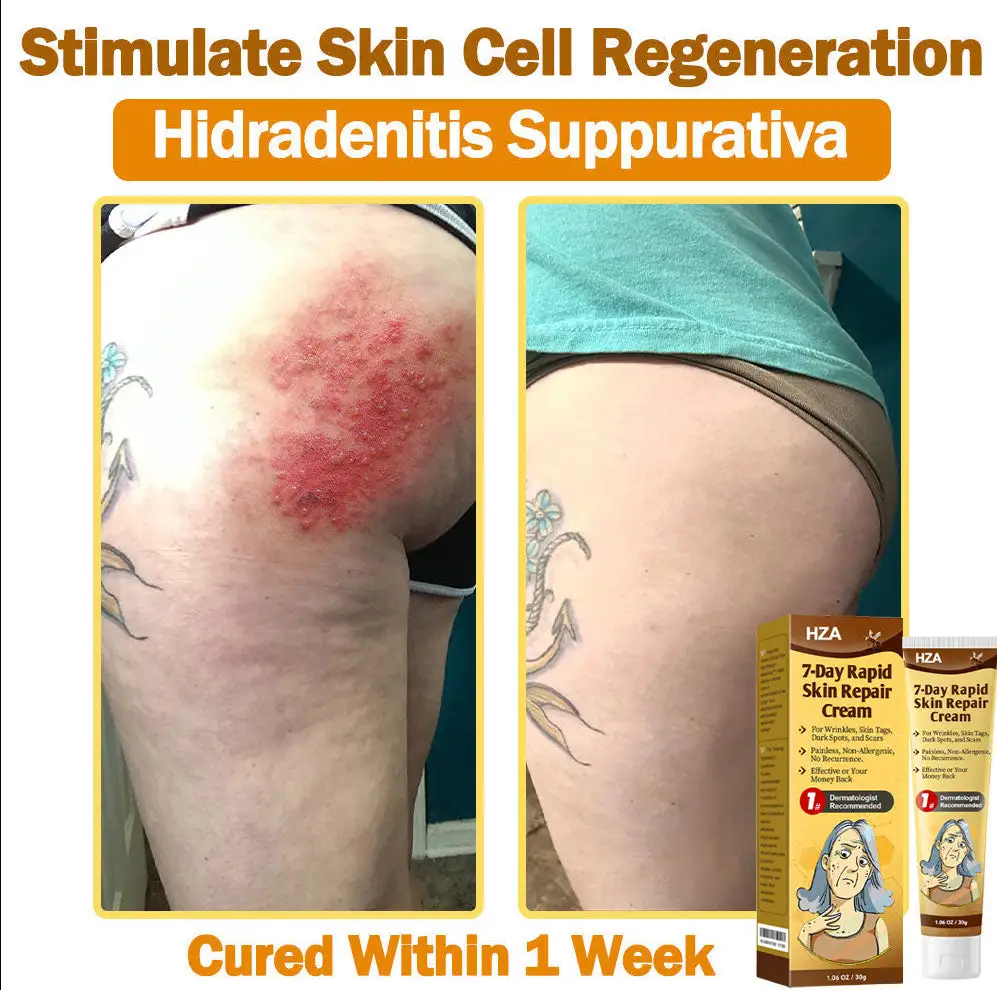 ๐-๐๐๐ฒ ๐๐๐ฉ๐ข๐ ๐๐ค๐ข๐ง ๐๐๐ฉ๐๐ข๐ซ ๐๐ซ๐๐๐ฆ - Image 4