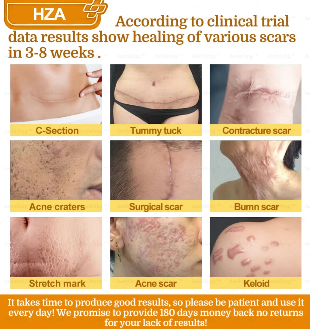 ๐-๐๐๐ฒ ๐๐๐ฉ๐ข๐ ๐๐ค๐ข๐ง ๐๐๐ฉ๐๐ข๐ซ ๐๐ซ๐๐๐ฆ - Image 5