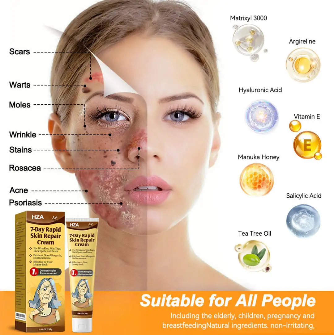 ๐-๐๐๐ฒ ๐๐๐ฉ๐ข๐ ๐๐ค๐ข๐ง ๐๐๐ฉ๐๐ข๐ซ ๐๐ซ๐๐๐ฆ - Image 6