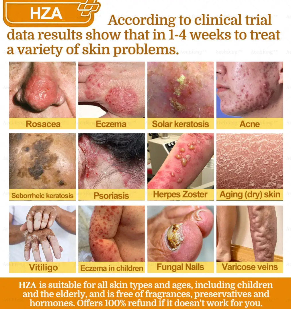 ๐-๐๐๐ฒ ๐๐๐ฉ๐ข๐ ๐๐ค๐ข๐ง ๐๐๐ฉ๐๐ข๐ซ ๐๐ซ๐๐๐ฆ - Image 7