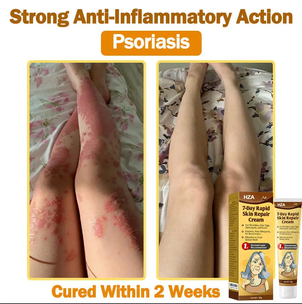 ๐-๐๐๐ฒ ๐๐๐ฉ๐ข๐ ๐๐ค๐ข๐ง ๐๐๐ฉ๐๐ข๐ซ ๐๐ซ๐๐๐ฆ - Image 8