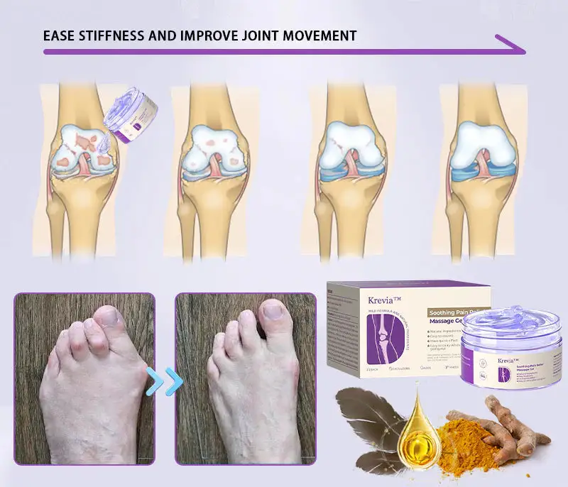 Turmeric & Emu Oil Arthritis Soothing Pain Relief Massage Gel for Stiff Joints & Aches - Image 4