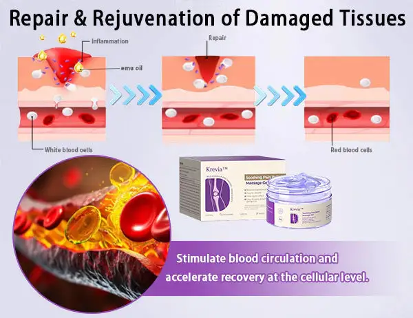 Turmeric & Emu Oil Arthritis Soothing Pain Relief Massage Gel for Stiff Joints & Aches - Image 5