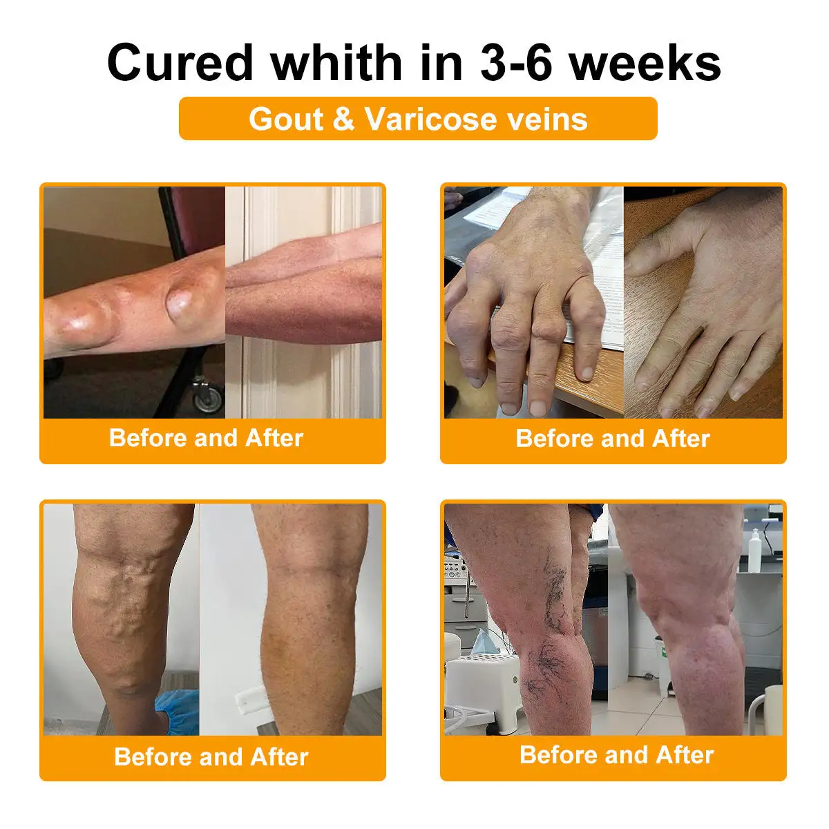 Bee Venom Pain-Relief Bone Healing Cream - Image 4