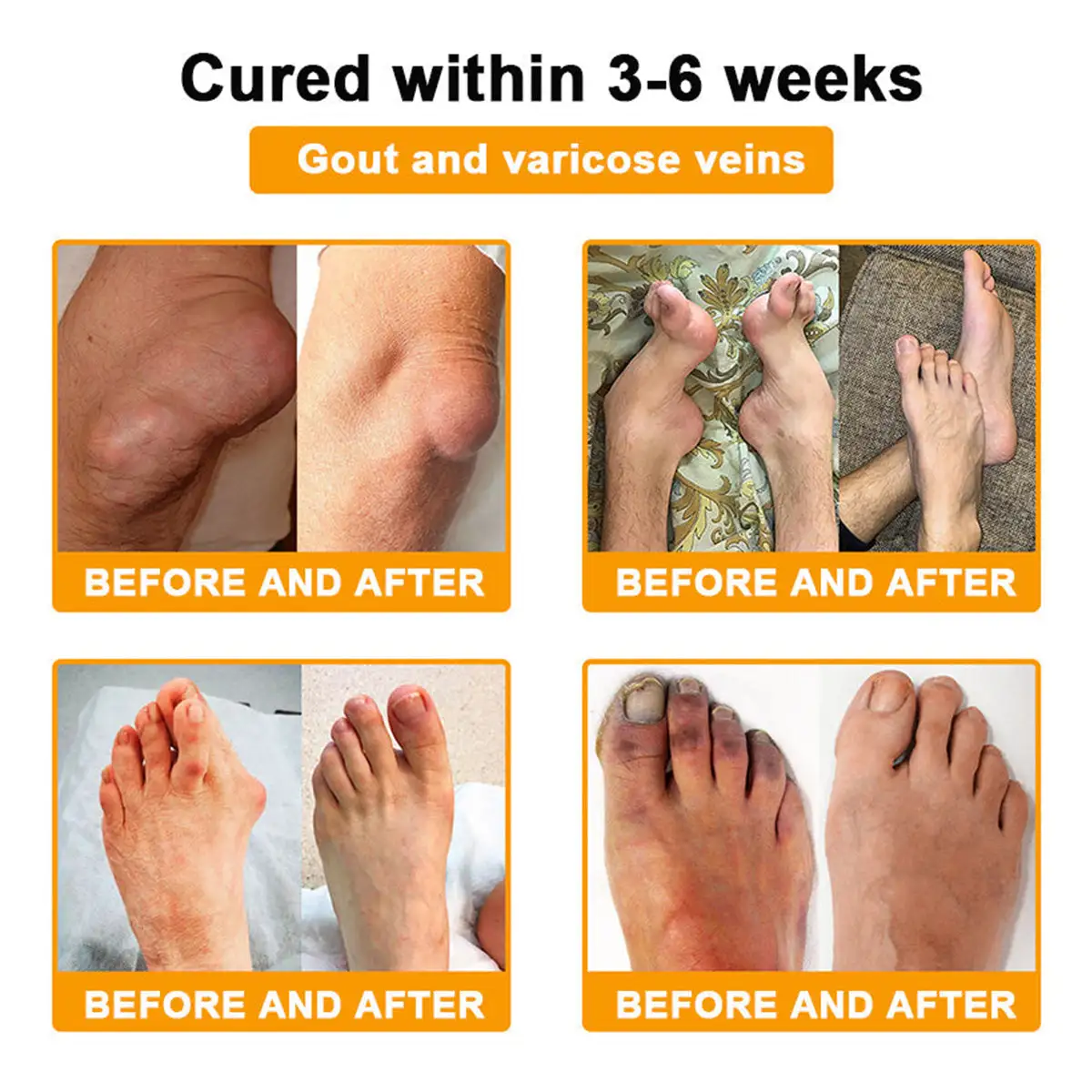 Bee Venom Pain-Relief Bone Healing Cream - Image 5