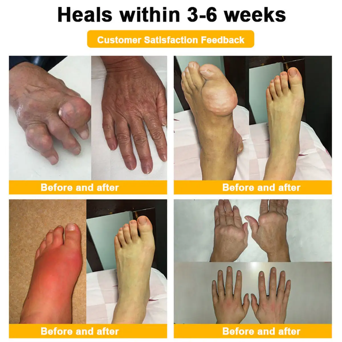 Bee Venom Pain-Relief Bone Healing Cream - Image 6