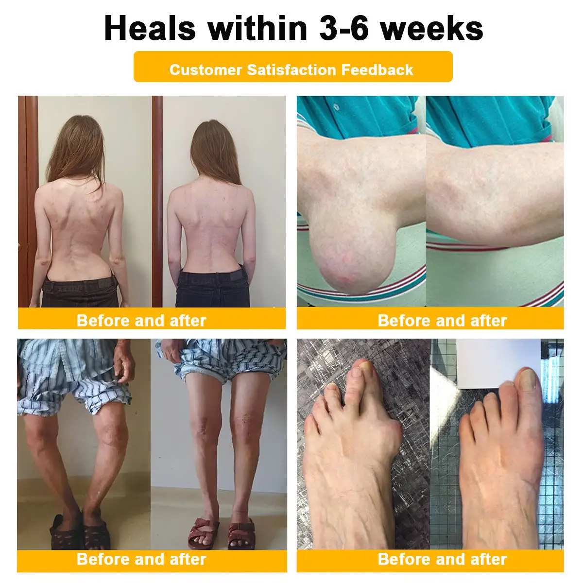 Bee Venom Pain-Relief Bone Healing Cream - Image 7