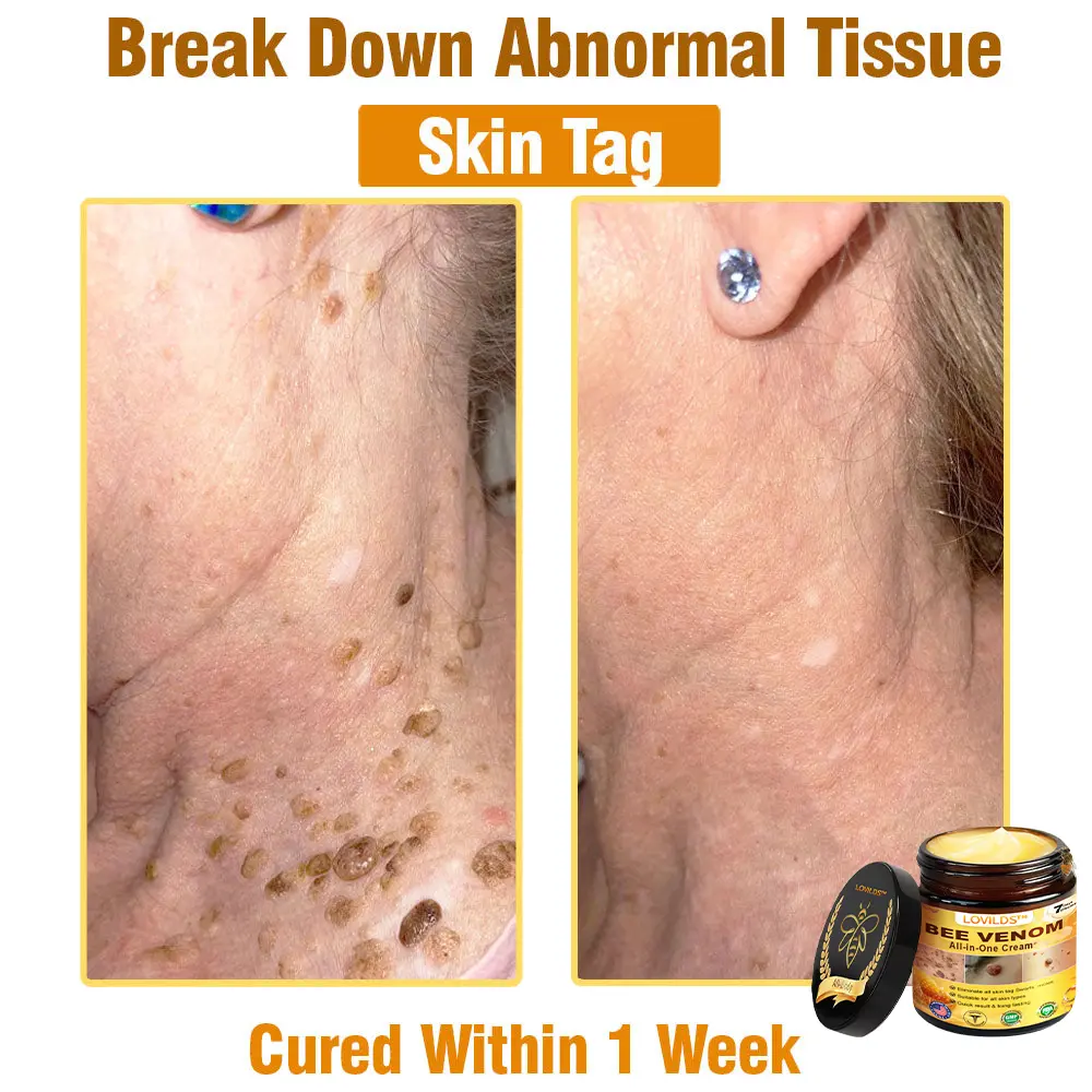 Bee Venom All-in-One Cream - Image 12