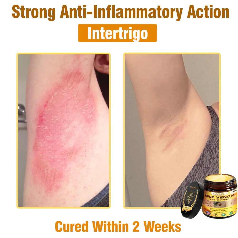 Bee Venom All-in-One Cream - Image 4