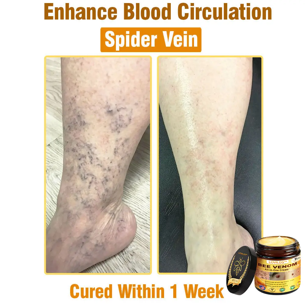 Bee Venom All-in-One Cream - Image 6