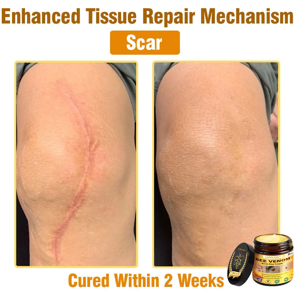 Bee Venom All-in-One Cream - Image 9