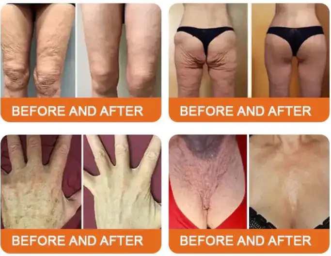 Bee Venom Lift Cream - Image 3