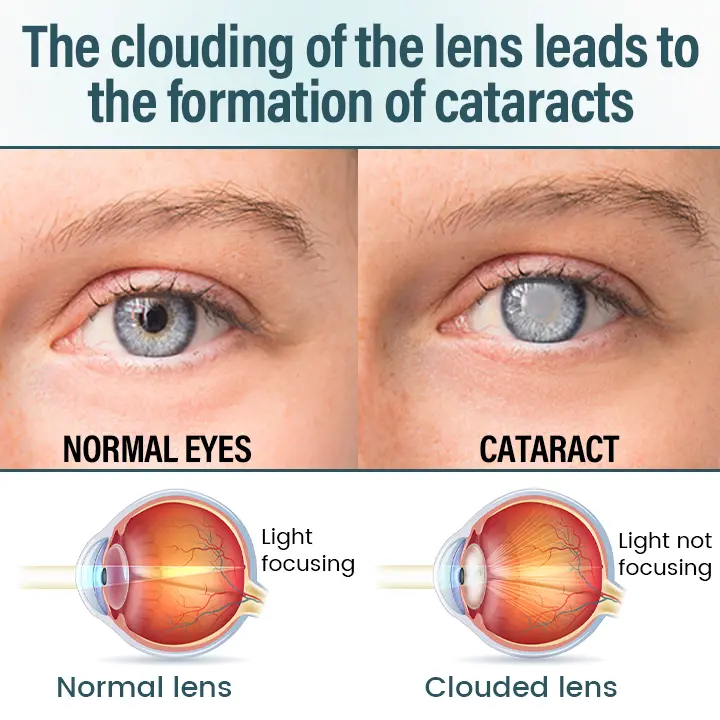 OptiFusion Nano Eye Drops Serum - Image 4